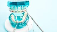 مصادر أجهزة تقويم الأسنان