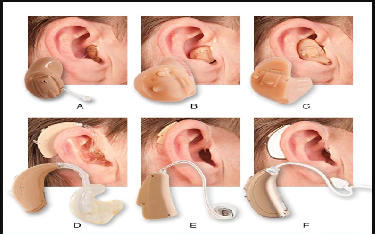 افضل شركات سماعات ضعف السمع